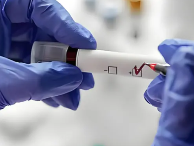 Earnings Released! Roche’s Molecular Business Plunged 36%, Hologic’s dropped 26%