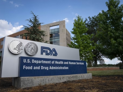 FDA clears blood test to help rule out Alzheimer’s disease in people showing symptoms