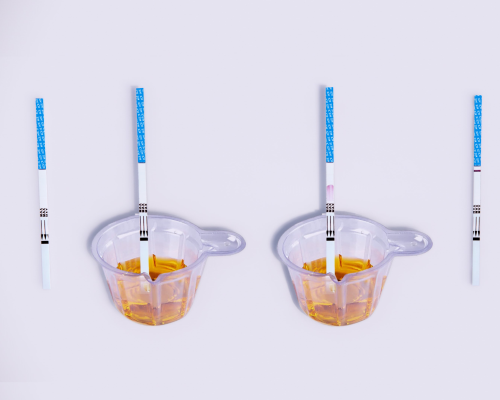 Acetaminophen (ACE) Rapid Test Kit (Urine)