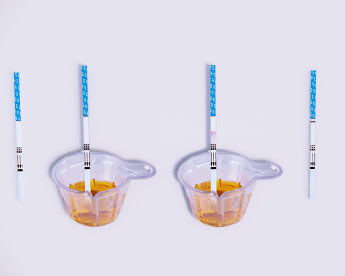 Propoxyphene (PPX) Rapid Test Kit (Urine)