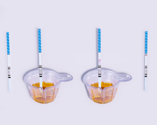 Ketamine (KET) Rapid Test Kit (Urine) Intended Use