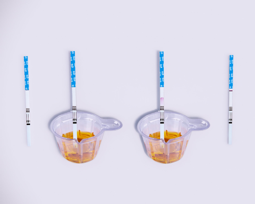 Ethyl Glucuronide (ETG) Rapid Test Kit (Urine)